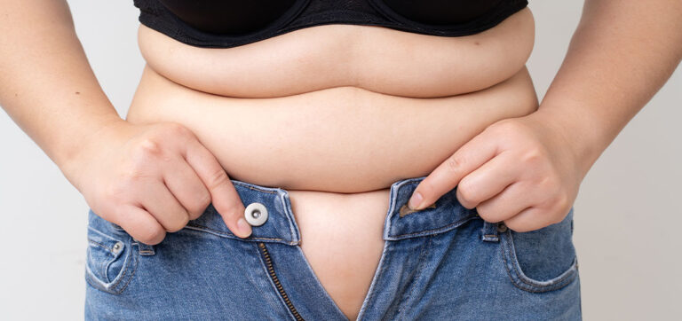 Read more about the article Übergewicht dauerhaft loswerden